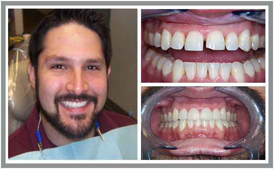 Dental Patient Teeth Case Study | East Cooper Dental | Family Dentists in Charleston SC