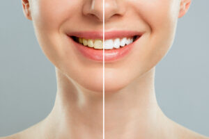 mount pleasant cosmetic dentistry