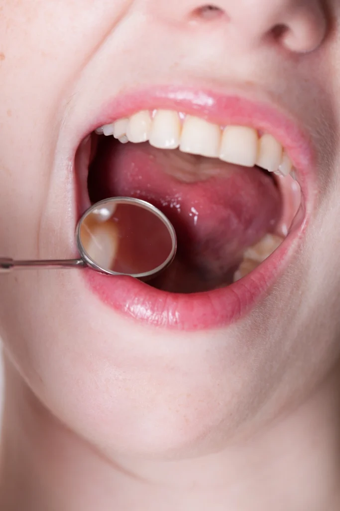 What Is Periodontal Disease?​
